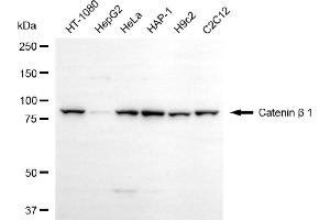 Western blotting analysis using catenin beta 1 antibody (ABIN7797931). (CTNNB1 抗体)
