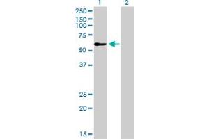 Western Blot analysis of TRAF6 expression in transfected 293T cell line by TRAF6 monoclonal antibody (M02), clone 1B2. (TRAF6 抗体  (AA 413-522))
