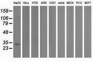 Image no. 1 for anti-Peroxisomal Trans-2-Enoyl-CoA Reductase (PECR) antibody (ABIN1500149) (PECR 抗体)