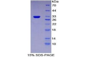 SDS-PAGE analysis of Mouse Multidrug Resistance-Associated Protein 1 Protein. (ABCC1 蛋白)