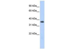 Image no. 1 for anti-Motor Neuron and Pancreas Homeobox 1 (MNX1) (AA 36-85) antibody (ABIN6740279) (MNX1 抗体  (AA 36-85))