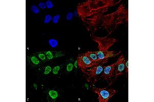 Immunocytochemistry/Immunofluorescence analysis using Mouse Anti-Cav3. (CACNA1G 抗体  (AA 2052-2172) (HRP))