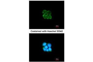 ICC/IF Image Immunofluorescence analysis of methanol-fixed A431, using SERPINF2, antibody at 1:200 dilution. (alpha 2 Antiplasmin 抗体  (Center))