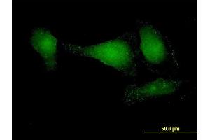 Immunofluorescence of purified MaxPab antibody to APPL2 on HeLa cell.