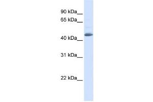 Western Blotting (WB) image for anti-Sorting Nexin 5 (SNX5) antibody (ABIN2459843) (SNX5 抗体)