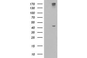 Western Blotting (WB) image for anti-1-Acylglycerol-3-Phosphate O-Acyltransferase 5 (Lysophosphatidic Acid Acyltransferase, Epsilon) (AGPAT5) antibody (ABIN1496501) (AGPAT5 抗体)