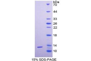 SDS-PAGE analysis of Human GCP2 Protein. (GCP2 蛋白)