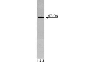 Western blot analysis of GGA2 on a EB-1 cell lysate (Human B lymphoblast, Burkitt's lymphoma, ATCC HTB-60). (GGA2 抗体  (AA 334-445))