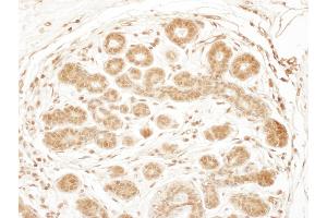 Immunohistochemistry (IHC) image for anti-Ribosomal Protein S6 Kinase, 90kDa, Polypeptide 2 (RPS6KA2) (AA 25-75) antibody (ABIN7453463)