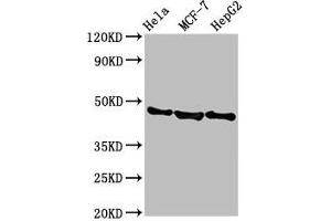 Western Blot Positive WB detected in: Hela whole cell lysate, MCF-7 whole cell lysate, HepG2 whole cell lysate All lanes: BFSP2 antibody at 3. (BFSP2 抗体  (AA 11-110))