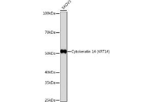 Western blot analysis of extracts of SKOV3 cells, using Cytokeratin 14 (KRT14) (KRT14) antibody (ABIN7268091) at 1:1000 dilution. (KRT14 抗体)