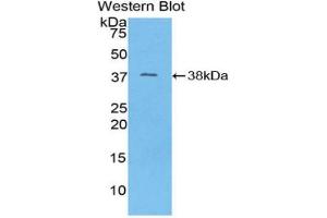 Western blot analysis of the recombinant protein. (MT-ND1 抗体  (AA 122-171))