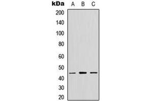 Western blot analysis of GPR13 expression in MCF7 (A), NS-1 (B), PC12 (C) whole cell lysates. (CX3CR1 抗体  (C-Term))