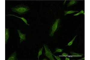Immunofluorescence (IF) image for anti-Proliferating Cell Nuclear Antigen (PCNA) (AA 78-177) antibody (ABIN518692)