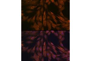 Immunofluorescence analysis of C6 cells using ULK3 Rabbit mAb (ABIN7271222) at dilution of 1:100 (40x lens). (ULK3 抗体)