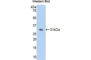 Western blot analysis of the recombinant protein. (CRP 抗体  (AA 20-225))