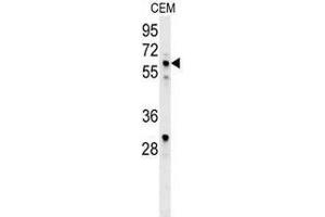 Western blot analysis in CEM cell line lysates (35ug/lane) using IKZF1/IKAROS Antibody (C-term). (IKZF1 抗体  (C-Term))