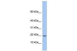 NDP antibody used at 1 ug/ml to detect target protein. (Norrie Disease (Pseudoglioma) 抗体)