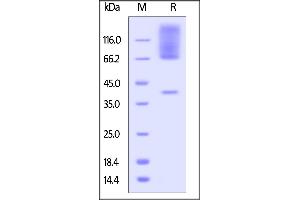 SDS-PAGE (SDS) image for Glypican 3 (GPC3) (AA 25-557) (Active) protein (His tag) (ABIN5526594)