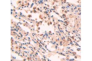 Immunohistochemistry (IHC) image for anti-TSC22 Domain Family, Member 1 (TSC22D1) (AA 803-1070) antibody (ABIN1871980)
