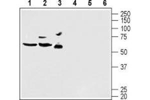 Western blot analysis of mouse brain lysate (lanes 1 and 4), rat brain lysate (lanes 2 and 5) and human U-87 MG glioblastoma cell lysate (lanes 3 and 6): - 1-3. (KCND2 抗体  (C-Term, Intracellular))