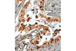 Immunohistochemistry (IHC) image for anti-Steroid-5-alpha-Reductase, alpha Polypeptide 1 (3-Oxo-5 alpha-Steroid delta 4-Dehydrogenase alpha 1) (SRD5A1) (N-Term) antibody (ABIN185346)