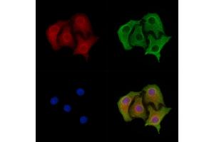 ABIN6263681 and ABIN6278316 staining Hela cells by IF/ICC.