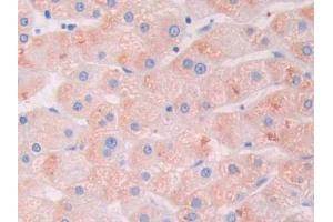 DAB staining on IHC-P; Samples: Human Liver Tissue (LGALS9B 抗体  (AA 17-148))