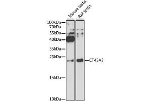 Western blot analysis of extracts of various cell lines, using CT45A3 antibody. (CT45A3 抗体)
