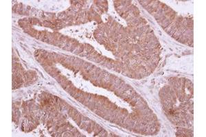 Image no. 1 for anti-NME Gene Family Member 9 (NME9) (AA 1-142) antibody (ABIN1501588) (NME9 抗体  (AA 1-142))
