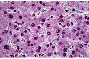 Human Liver: Formalin-Fixed, Paraffin-Embedded (FFPE) (SGK1 抗体  (AA 1-91))