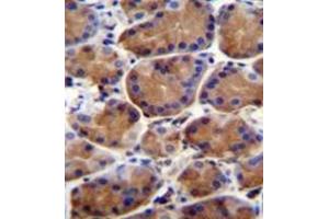 Immunohistochemistry analysis in formalin fixed and paraffin embedded human stomach tissue reacted with LRWD1 Antibody (N-term) followed which was peroxidase conjugated to the secondary antibody and followed by DAB staining. (LRWD1 抗体  (N-Term))