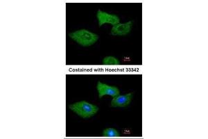 ICC/IF Image Immunofluorescence analysis of methanol-fixed A549, using RGS2, antibody at 1:200 dilution. (RGS2 抗体)
