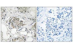 Immunohistochemistry (IHC) image for anti-Ubiquitin Specific Peptidase 13 (Isopeptidase T-3) (USP13) (C-Term) antibody (ABIN1852328) (USP13 抗体  (C-Term))