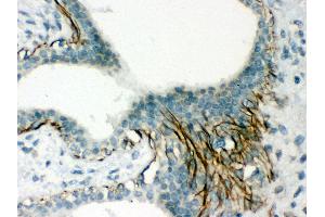 Immunohistochemistry (Paraffin-embedded Sections) (IHC (p)) image for anti-Actin, alpha 1, Skeletal Muscle (ACTA1) (AA 277-308), (C-Term) antibody (ABIN3043519)
