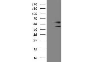 HEK293T cells were transfected with the pCMV6-ENTRY control (Left lane) or pCMV6-ENTRY C9orf41 (Right lane) cDNA for 48 hrs and lysed. (C9orf41 抗体)