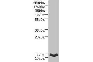 Western blot All lanes: MTHFD2L antibody at 6 μg/mL + Mouse lung tissue Secondary Goat polyclonal to rabbit IgG at 1/10000 dilution Predicted band size: 38, 32, 8, 25, 33 kDa Observed band size: 14 kDa (MTHFD2L 抗体  (AA 136-268))