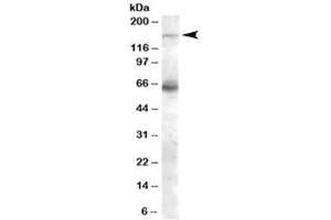 Western blot testing of human skeletal muscle lysate with NOS1 antibody at 0. (NOS1 抗体)