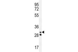 Neutrophil elastase antibody western blot analysis in A2058 lysate. (ELANE 抗体  (AA 13-39))
