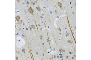 Immunohistochemistry of paraffin-embedded mouse brain using HTR3A antibody (ABIN5973293) at dilution of 1/100 (40x lens). (Serotonin Receptor 3A 抗体)