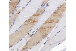 Immunohistochemistry analysis of paraffin-embedded rat skeletal muscle using SLC6A8 (ABIN7075678) at dilution of 1: 400 (SLC6A8 抗体)