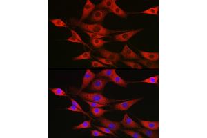 Immunofluorescence (IF) image for anti-Signal Sequence Receptor, beta (Translocon-Associated Protein Beta) (SSR2) antibody (ABIN7270299)