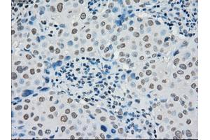 Image no. 2 for anti-Premelanosome Protein (PMEL) antibody (ABIN1500300) (Melanoma gp100 抗体)