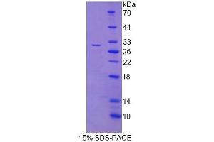 SDS-PAGE analysis of Human FIBP Protein. (FIBP 蛋白)