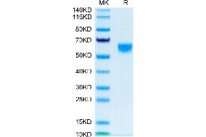 Mouse IL-9 on Tris-Bis PAGE under reduced condition. (IL-9 Protein (AA 19-144) (Fc Tag))