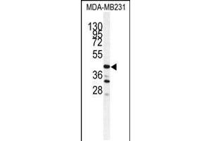 Western blot analysis of CTSS antibody in MDA-MB231 cell line lysates (35ug/lane) (Cathepsin S 抗体  (AA 210-240))