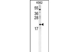 CH Antibody (Center) (ABIN651719 and ABIN2840373) western blot analysis in K562 cell line lysates (15 μg/lane). (PMCH 抗体  (AA 94-122))