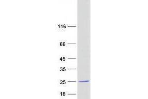 Western Blotting (WB) image for Coatomer Protein Complex, Subunit zeta 1 (COPZ1) protein (Myc-DYKDDDDK Tag) (ABIN2712936)