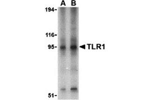 Western Blotting (WB) image for anti-Toll-Like Receptor 1 (TLR1) (Middle Region) antibody (ABIN1031127) (TLR1 抗体  (Middle Region))