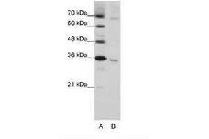 Image no. 1 for anti-Wingless-Type MMTV Integration Site Family, Member 5B (WNT5B) (C-Term) antibody (ABIN203075) (WNT5B 抗体  (C-Term))